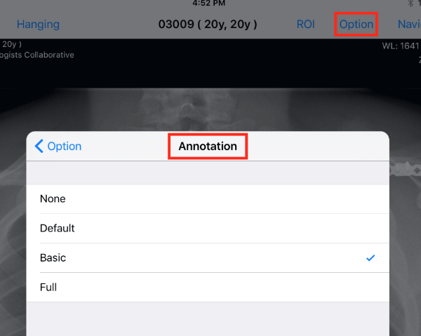 Annotations Options