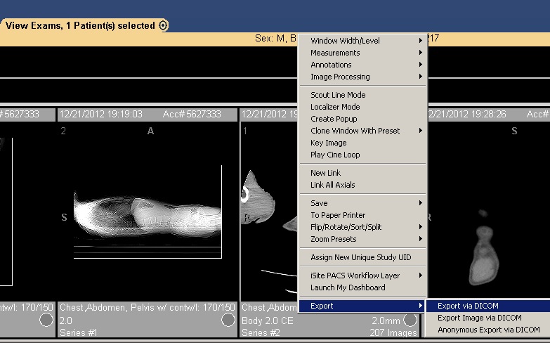 DICOM Export