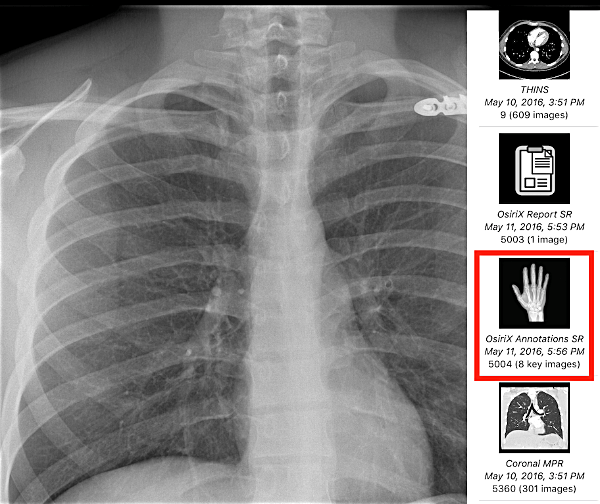 MF Key Images