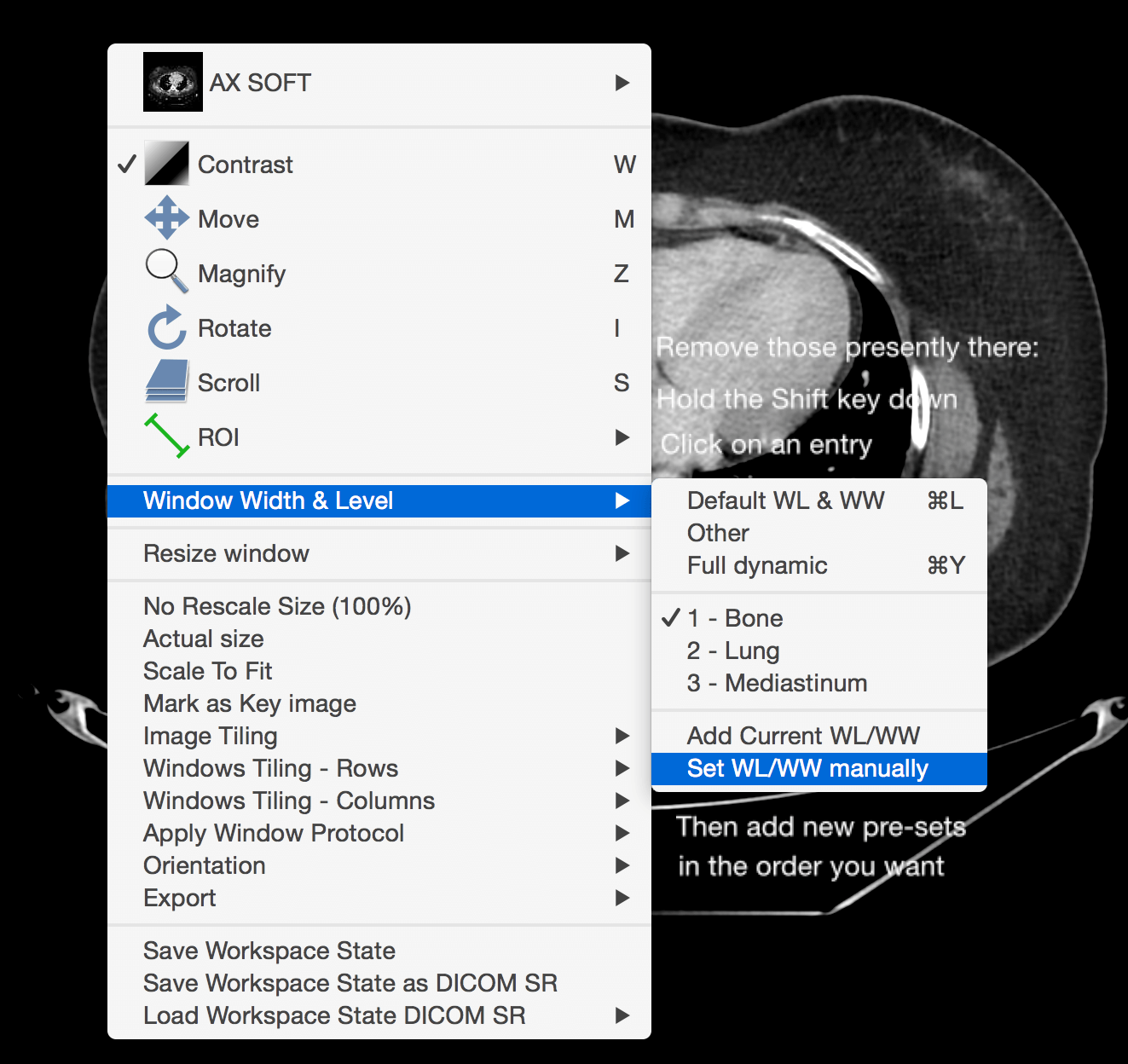 New Presets