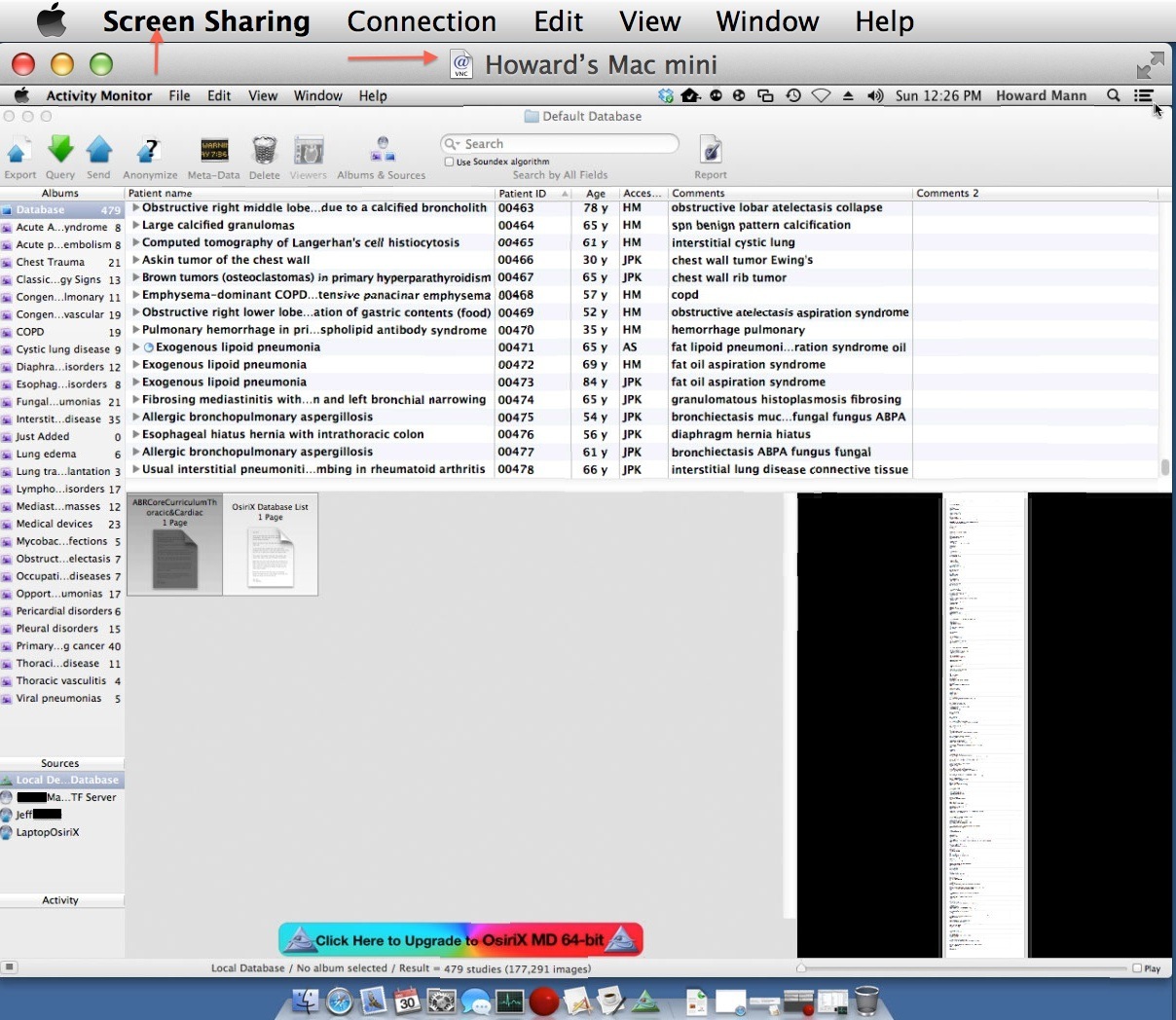 osirix md vs lite