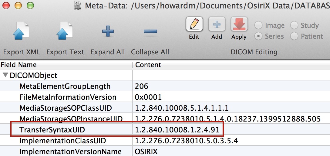 Transfer Syntax UID